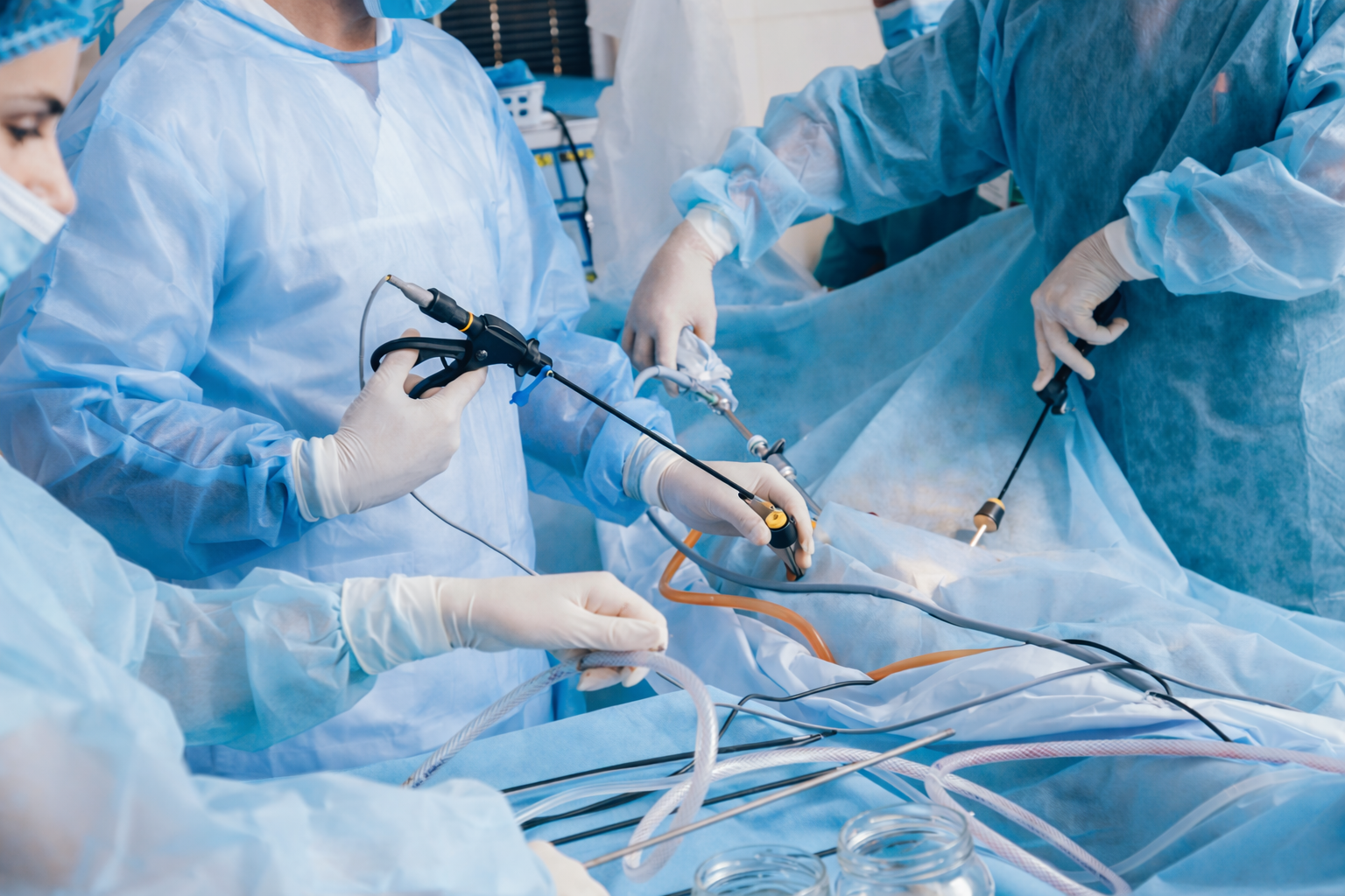 laproscopy Surgery