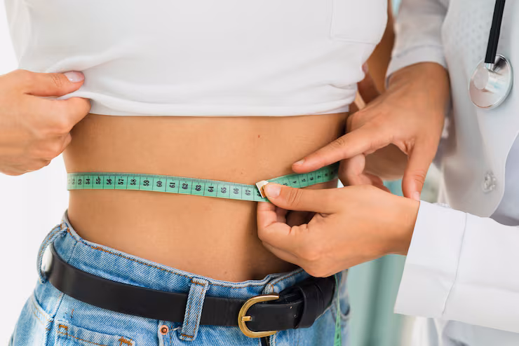 Bariatric Surgery
